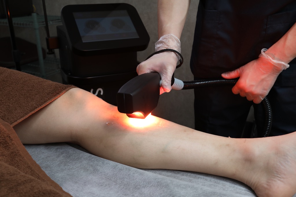 ほとんど痛みを感じなかったので、これだけ足の毛が減るとは思わなかったです‼️