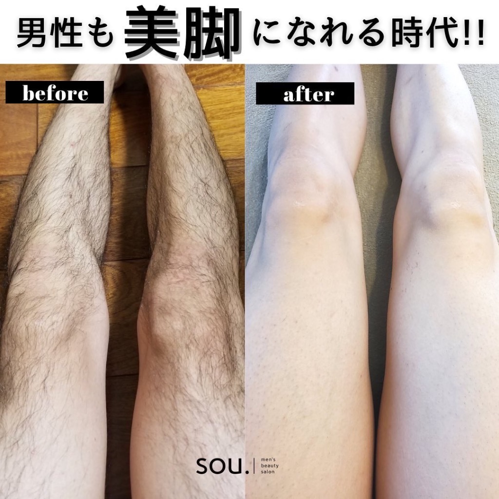 男性も美脚になれる時代‼️